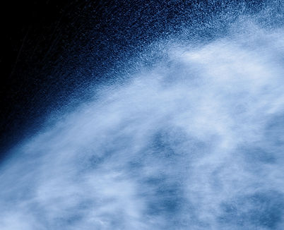 Spray