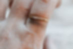 gold ring leaving green or black smudge on skin