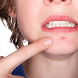 Medical Dermatology