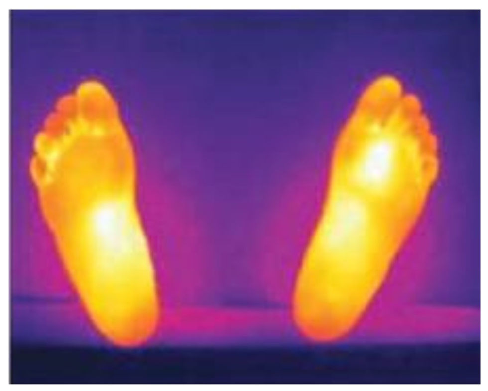 THERMOGRAPHIC IMAGING