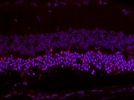 Publication: C3 in the retina