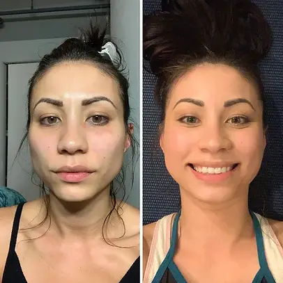 anti-aging-transform-skin-apperance