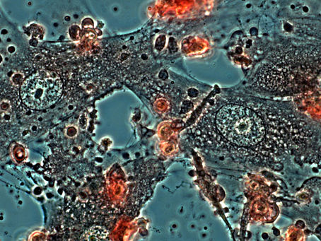 The stem cells inside your esophagus