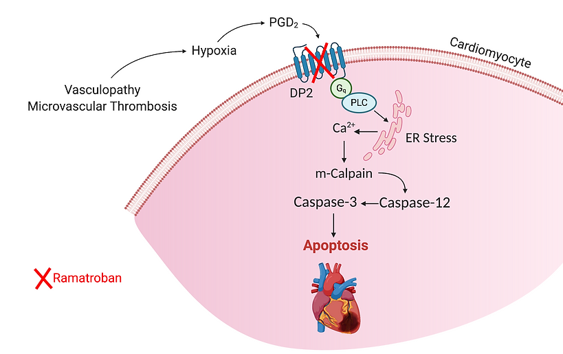 Myocarditis in COVID-19 and SCD copy (1)