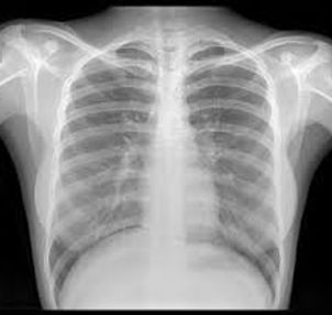 xray.jpg