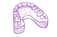 Retainer_neu (1).webp