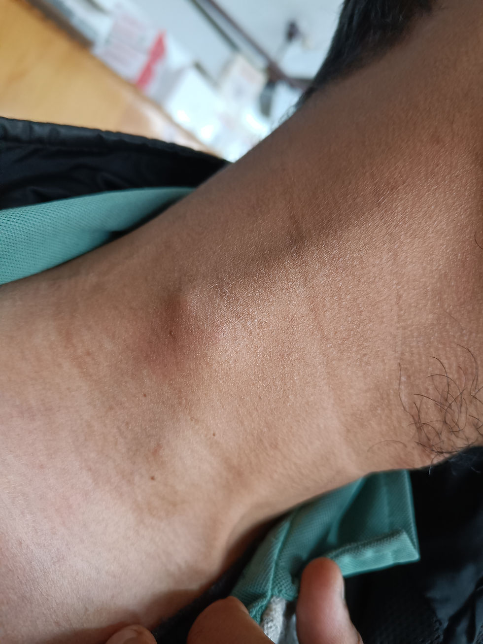 Image 1. Showing swelling over right side of neck.