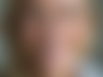 The Benefits of Botox for Seniors: Enhancing Aesthetics and Confidence with Expert Insights