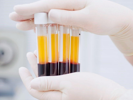 QUE ES EL PLASMA Y SUS BENEFICIOS