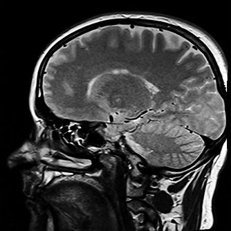 head-254863_1280.jpg