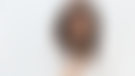 ¿Sabes qué es la Periimplantitis y por qué afecta a los implantes dentales?