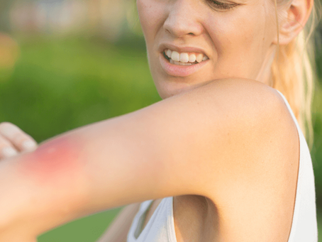Are Mosquitoes Bad in Florida? Delray Beach, Port St. Lucie, FL
