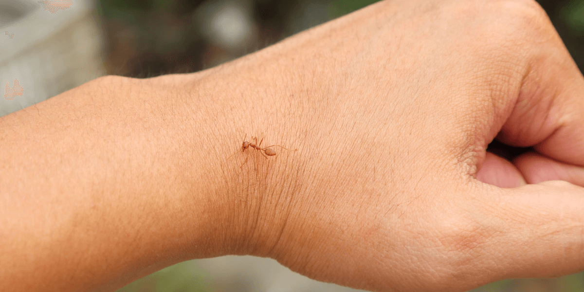 A lone ant on a person's wrist, giving it a painful bite