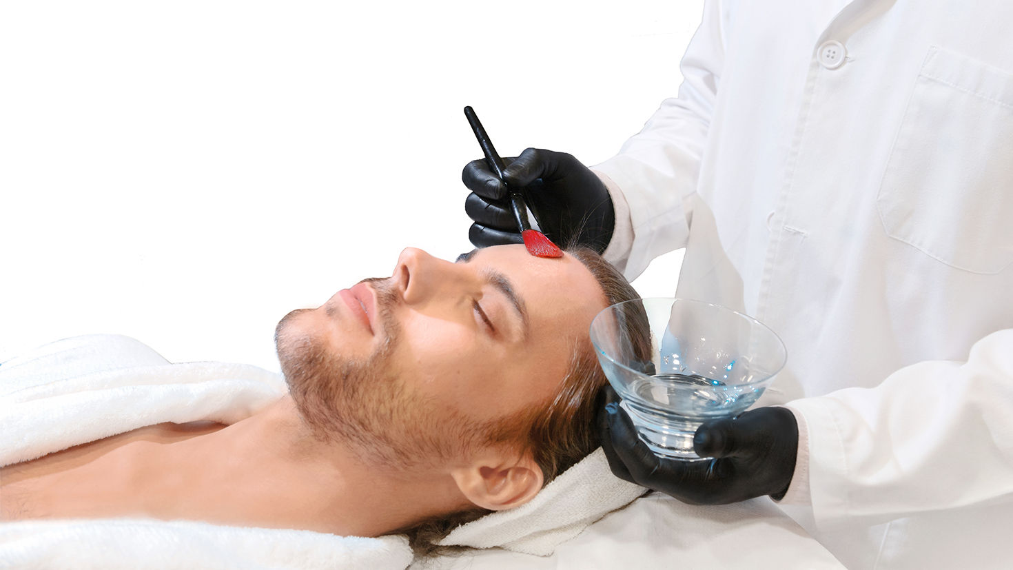 Peeling químico facial