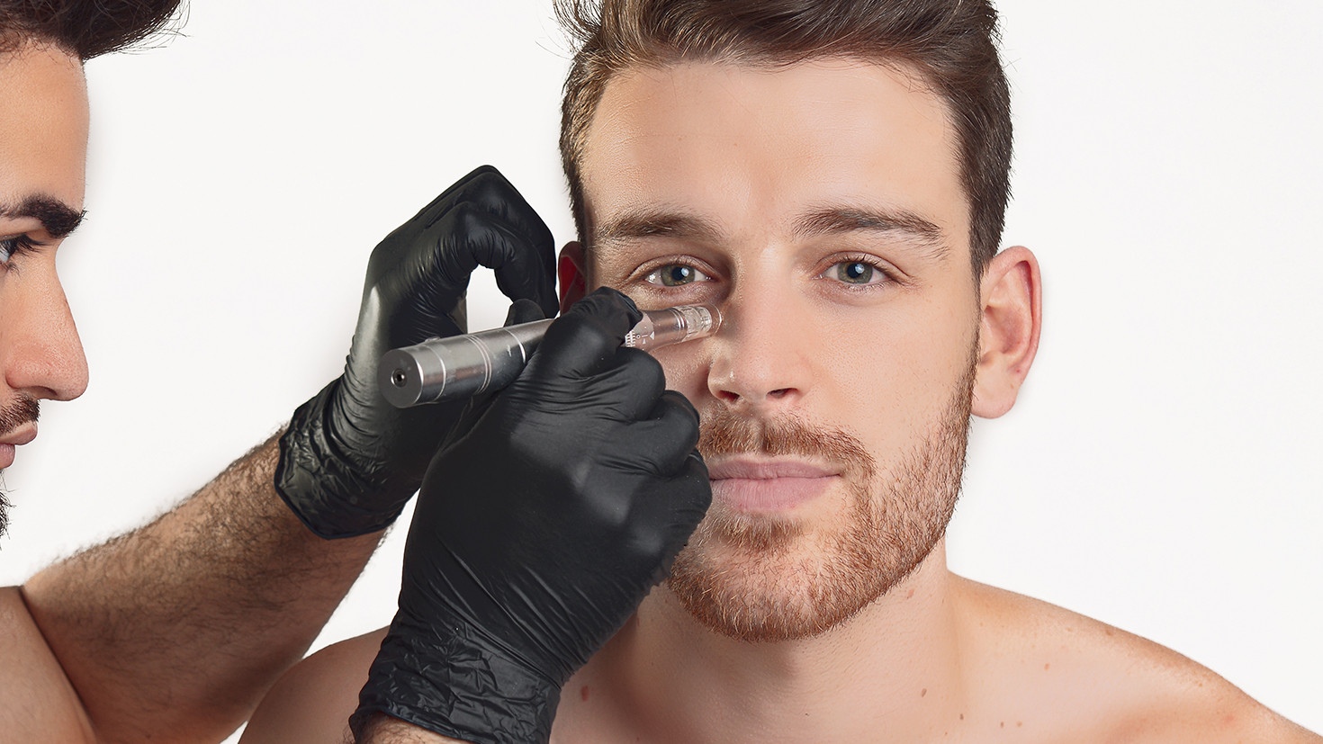 Carboxiterapia Ojeras
