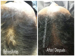 Female Hair Pigmentation