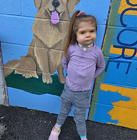 moebius syndrome, many faces of moebius syndrome