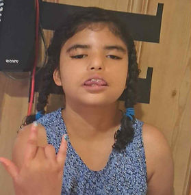 moebius syndrome, many faces of moebius syndrome