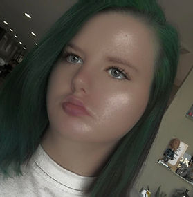 Many Faces of Moebius Syndrome Community member telling her story.