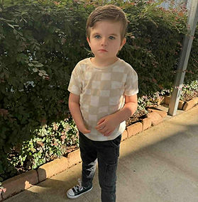 moebius syndrome, many faces of moebius syndrome