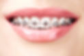 damon-braces-hero.jpg