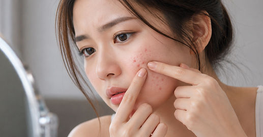 Skin & Acne Protocol Kota Kinabalu