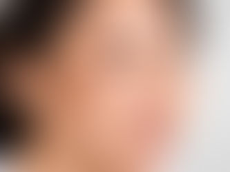 Pelindung Matahari & Melasma: Bahagian yang Semua Orang Pandang Ringan