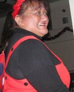 Me at the height of my diabetes