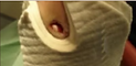 cuidado pie diabético.png