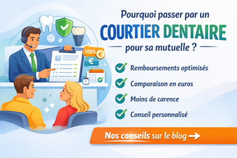 Implants et couronnes : comment choisir la bonne mutuelle ?