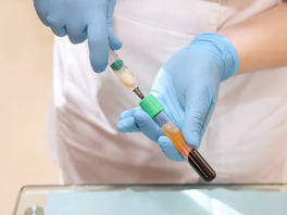 I-PRF: The Next Generation of Platelet-Rich Fibrin for Tissue Regeneration