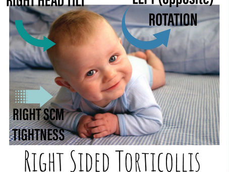 What is Torticollis and how can I help manage it for my child?