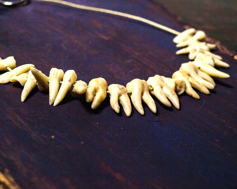 Meet 10 Artists Making Jewelry Out of Human Teeth