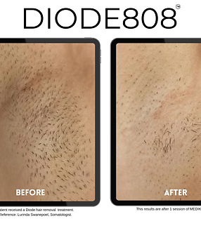 biomedika nivu jelymoo (13).png