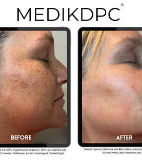 biomedika nivu jelymoo (10).png