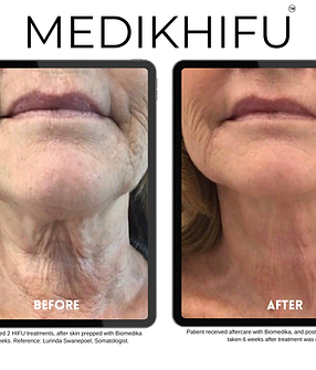 biomedika nivu jelymoo (12).png