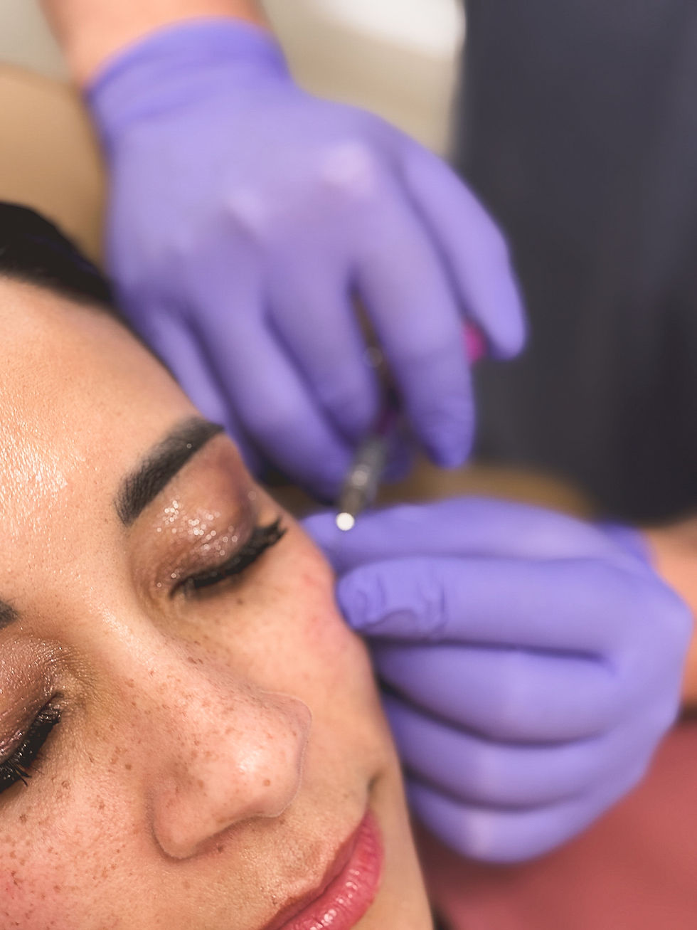 Aesthetic treatment being performed at Freya Aesthetics and Wellness, serving Zanesville, OH, and Johnstown, OH