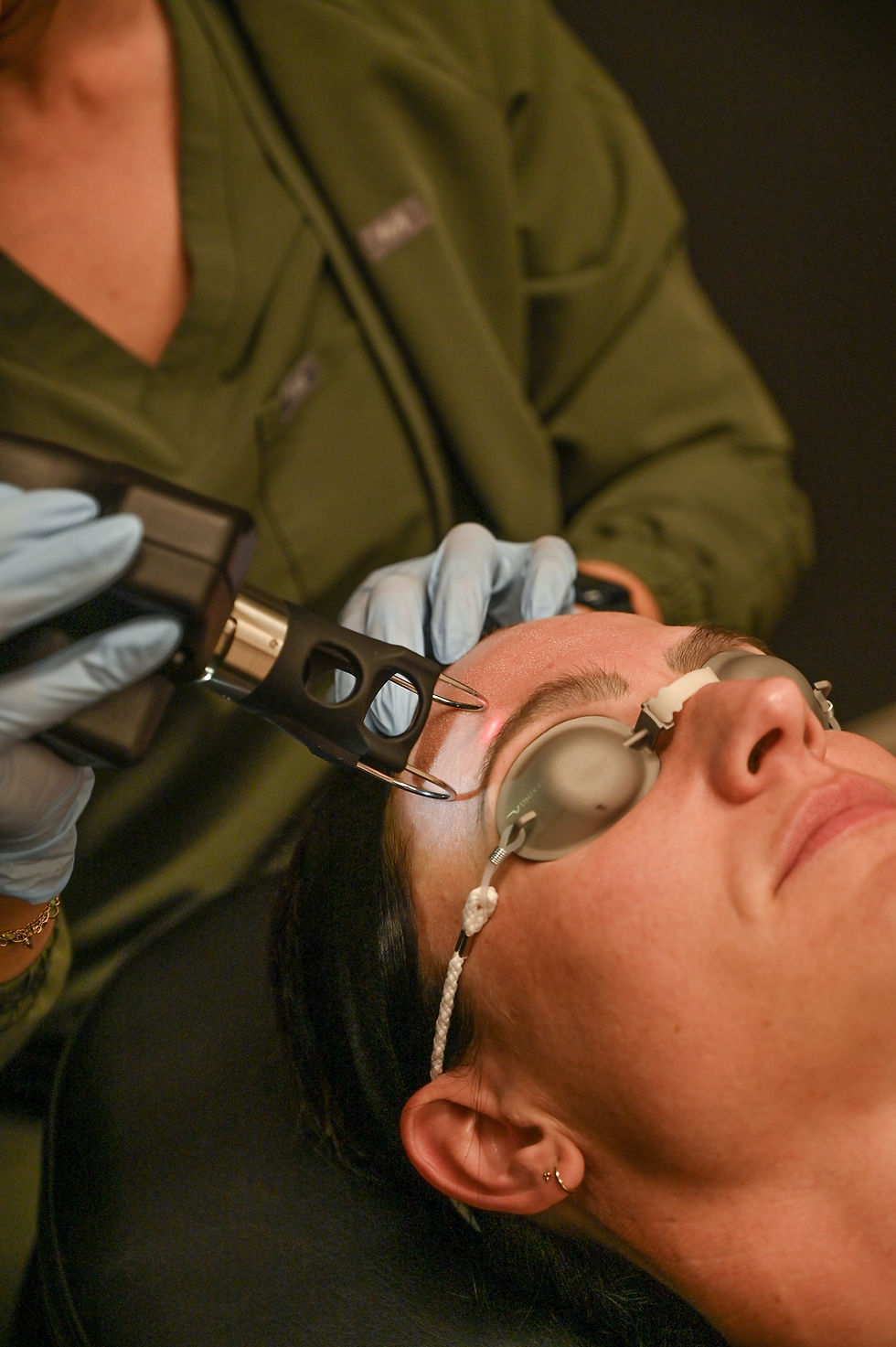 CoolPeel CO2 laser treatment for skin resurfacing