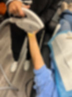 IPL Therapy for skin rejuvenation, increased skin tone, treat sun-damaged skin, uneven pigmentation, rough texture, and skin laxity in Lebanon, TN