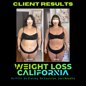 Weight Loss California, San Diego | 2650 Camino del Rio N