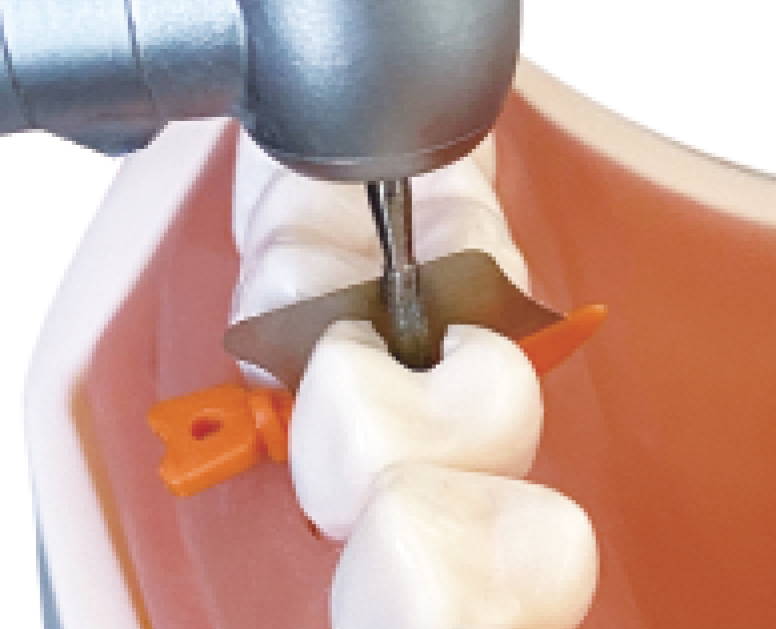 Thumbnail: Wedge Guards