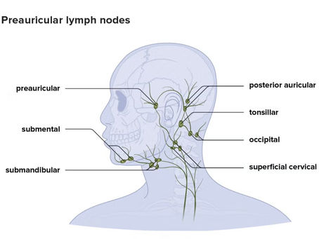 Lymph Nodes effecting the ear