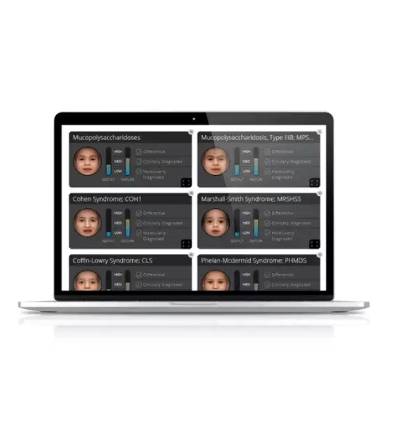 facial recognition genetic analysis software displaying patient phenotypes and diagnostic matching dashboard