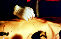 Surgery