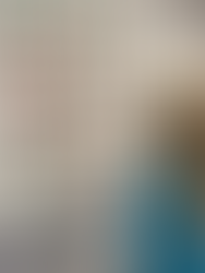 cheapest vision therapy