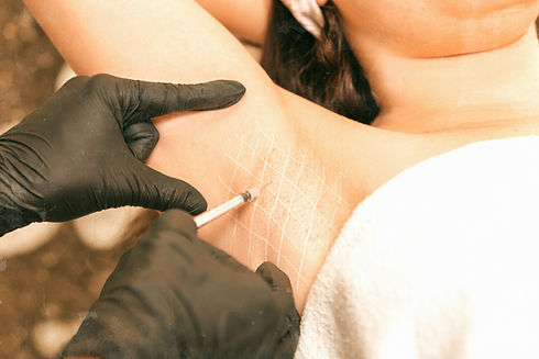 armpit botox lapwing aesthetics great yarmouth_edited.jpg