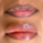 Lip Neutralization