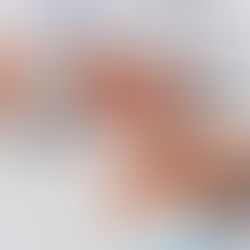 BRCA基因與前列腺癌：有何關聯？
