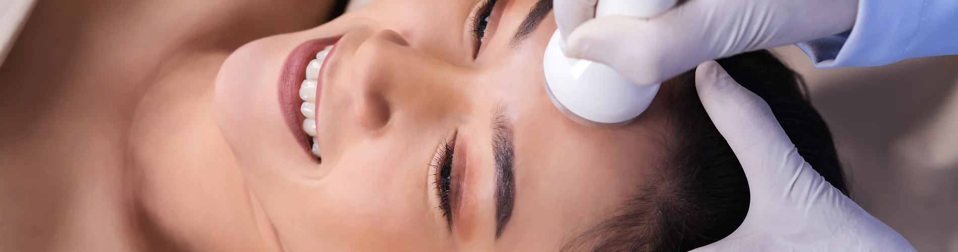 Formation microneedling Orléans
