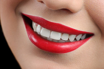 Sonrisa 02.jpg